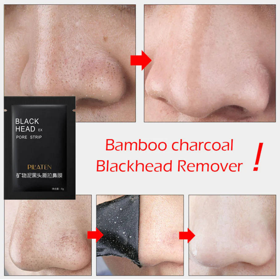 Blackhead Removal Nose Mask - Set of 10 Pack