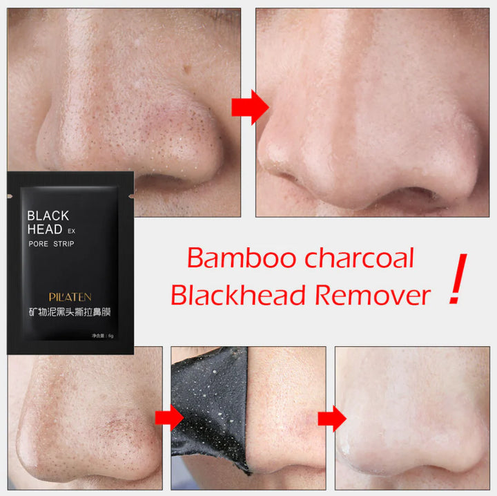Blackhead Removal Nose Mask - Set of 10 Pack