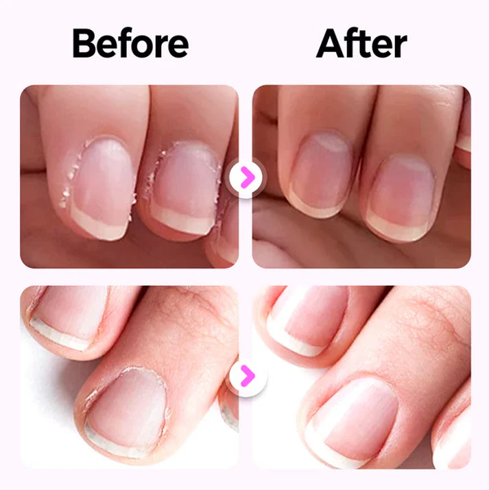 3-in-1 Nail Care Pen