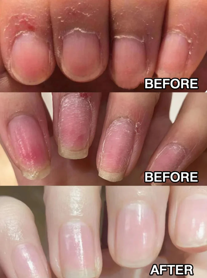 3-in-1 Nail Care Pen