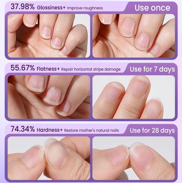 3-in-1 Nail Care Pen