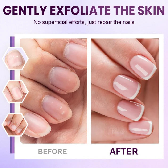 3-in-1 Nail Care Pen