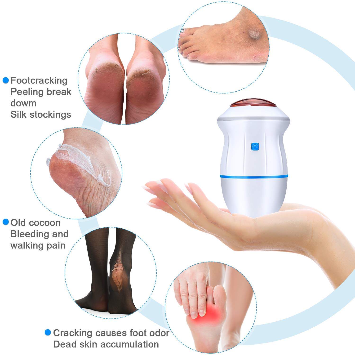 callus dead skin remover