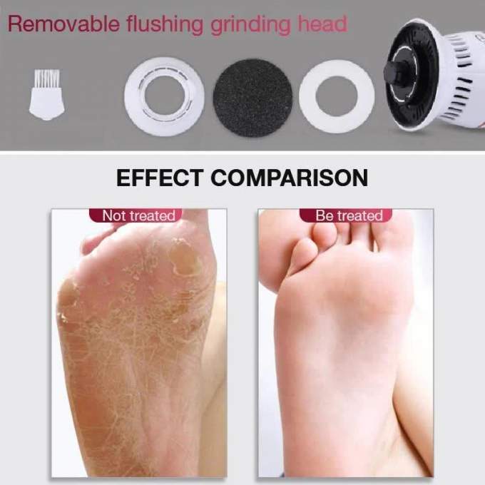 best callus remover