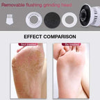 best callus remover